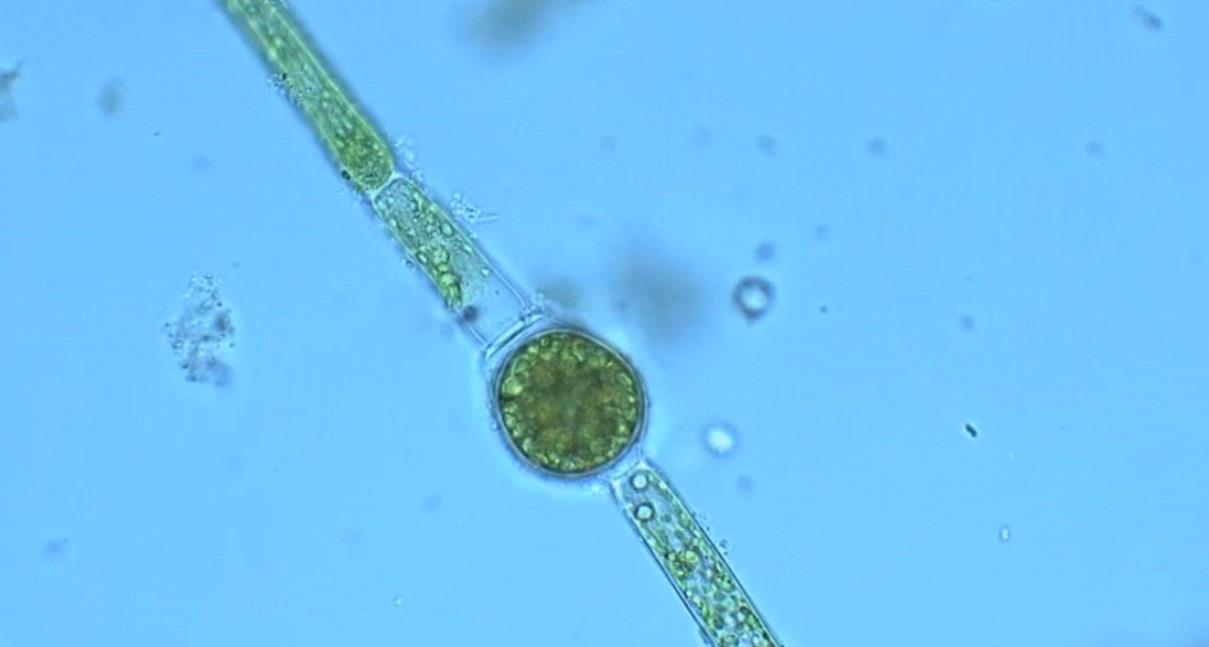 【视频】麦克奥迪AE31E倒置生物显微镜观察多种淡水藻类植物