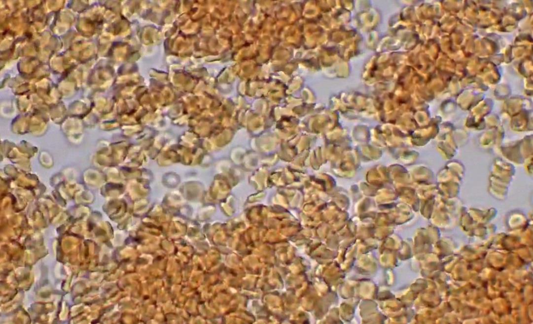 【视频】麦克奥迪数码显微镜BA310观察人体红细胞高清视频
